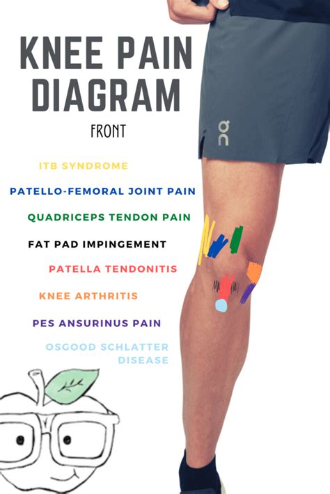 [DIAGRAM] Eyebrow Pain Diagram - MYDIAGRAM.ONLINE