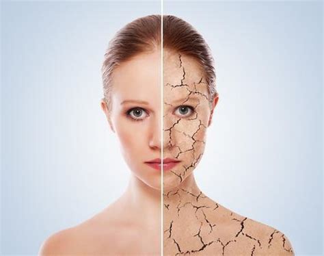 Dehydrated Skin: What You Need to Know