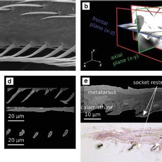 Focused ion beam (FIB) and scanning electron microscopy investigation ...