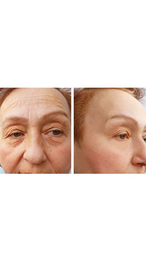 ageless before and after 10.5 - Anti-Age Naturally!