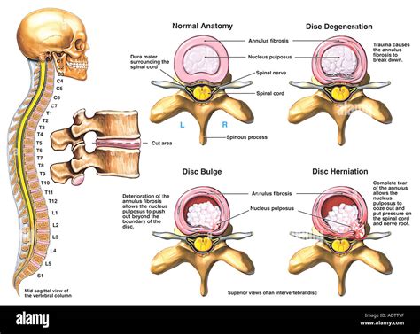 Intervertebral Disc Structure