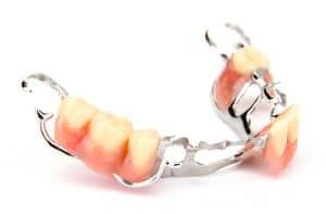 Cobalt Chrome Dentures - Information, Advantages, Prices