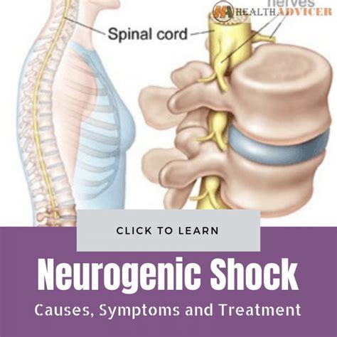 Neurogenic Shock : Causes, Picture, Symptoms And Treatment