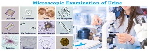 Microscopic Examination of Urine - MedicoInfo