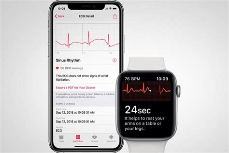 Apple Watch Series 4 users can now do ECGs from their wrists