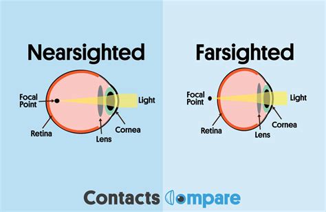 Nearsighted vs Farsighted | Contacts Compare