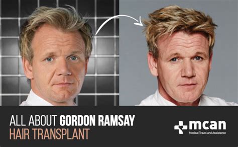 16+ Gordon Ramsey Hair - SoninAoiffe