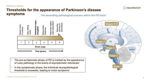 Parkinsons Disease - Course, Natural History and Prognosis - Neurotorium