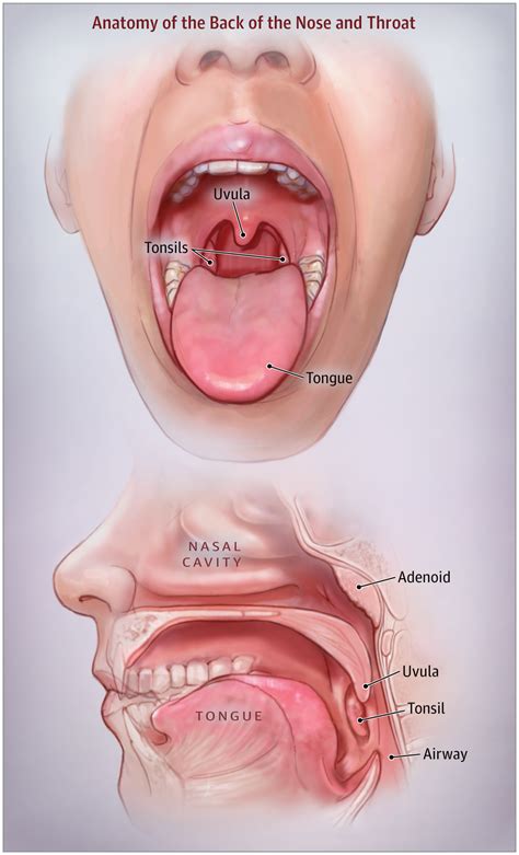 Tonsillectomy and Adenoidectomy in Children | Pediatrics | JAMA ...