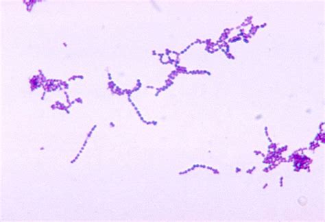 strep throat through a microscope