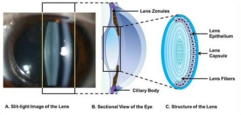 The Eye Lens: What You Need to Know