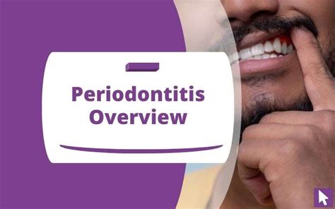 Periodontitis Overview: Symptoms, Causes, and Treatments