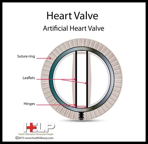 Heart Valve (Artificial Heart Valve) | A cardiovascular and blood boa…