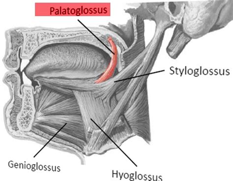 Anatomy, Head and Neck, Palatoglossus Muscle (Glossopalatinus ...