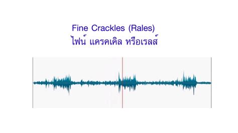 fine crackles - YouTube