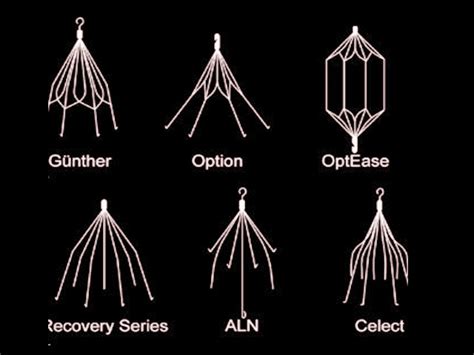 Inferior Vena Cava Filter - StatPearls - NCBI Bookshelf