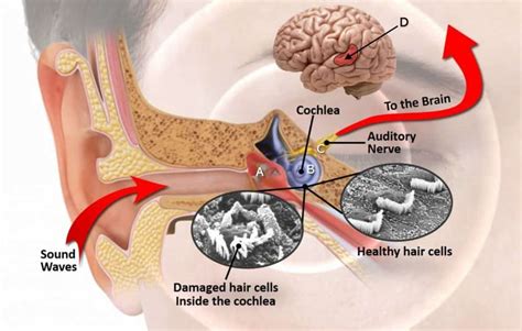 The Relationship Between Tinnitus and TMS Therapy + How It Can Deliver Relief For Patients