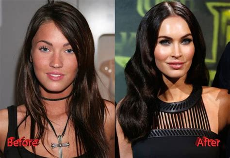 Megan Fox Before and After Plastic Surgery: A Tale of Evolution | ASEAN TV