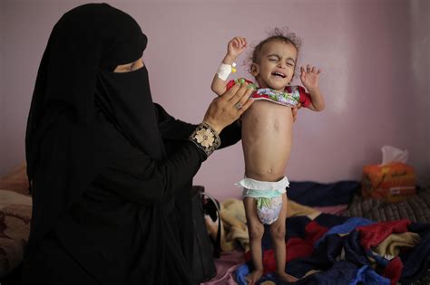 Yemen conflict escalates as country speeds toward famine: UN