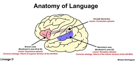 Aphasia - Neurology - Medbullets Step 1