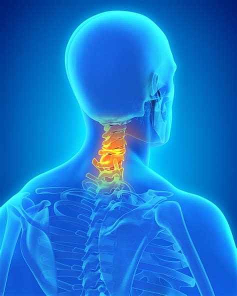 When to Seek Treatment for Neck Pain | The Center