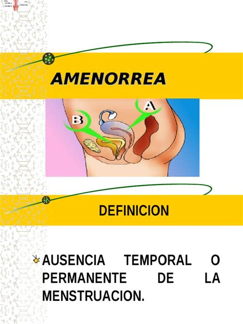 Amenorrea Primaria Secundaria | Hormona luteinizante | Ginecología