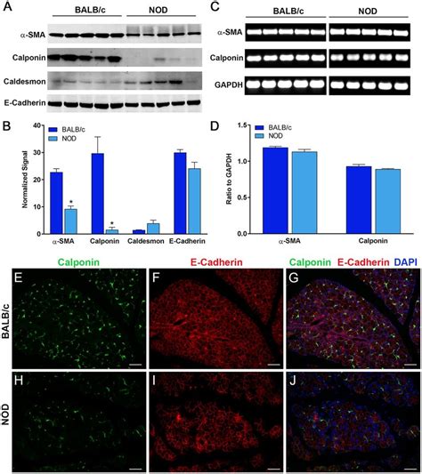 Decrease in smooth muscle associated proteins in NOD mice. Total ...