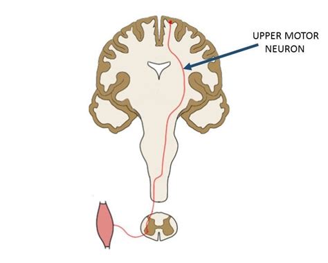 Upper Vs Lower Motor Neuron | Webmotor.org