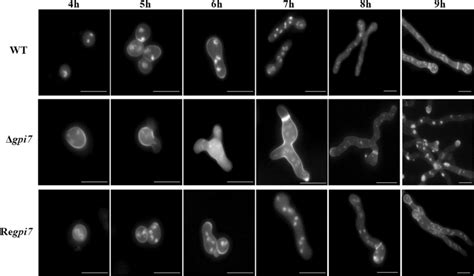 Conidia germination of the Δgpi7 mutant. Observation of conidia ...