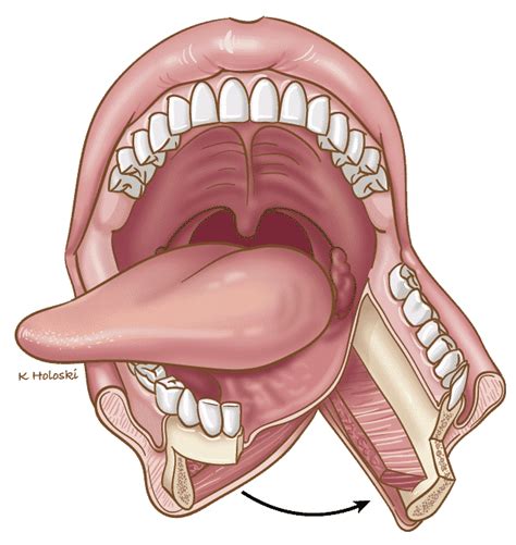 Glossectomy ‣ Surgery ‣ Treatments ‣ THANC Guide