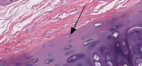 Cartilage | histology