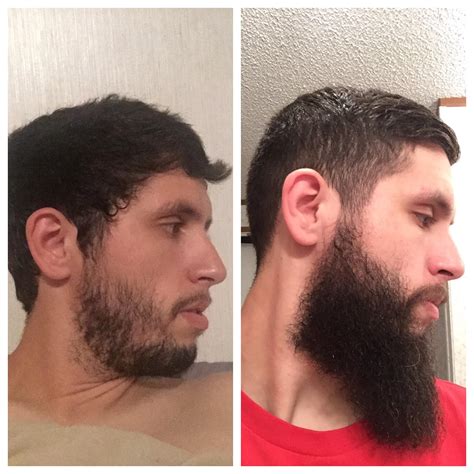 What 10 months of growth does to patches : r/beards