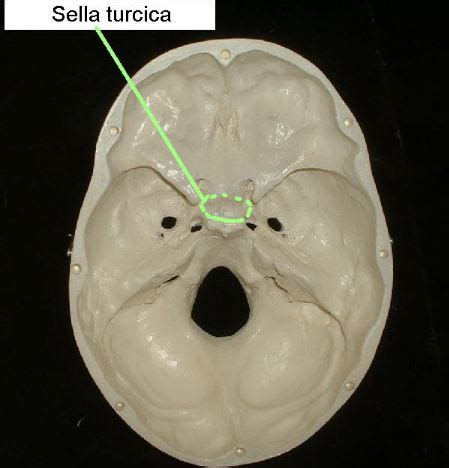 Sella Turcica - Bone, Function, Site, Location, Anatomy, Empty Sella