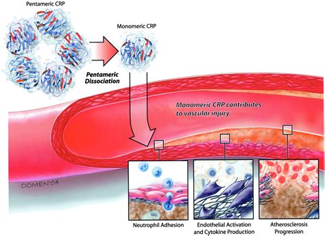 Measuring Your C Reactive Protein Levels - DrJockers.com