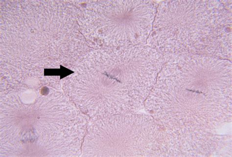 Metaphase Mitosis Under Microscope