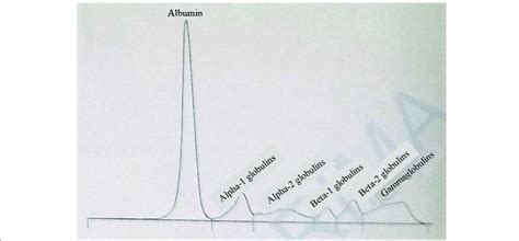 Serum protein electrophoresis curve. Normal total protein and gamma... | Download Scientific Diagram