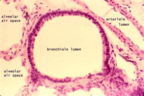 Bronchus Slide Labelled