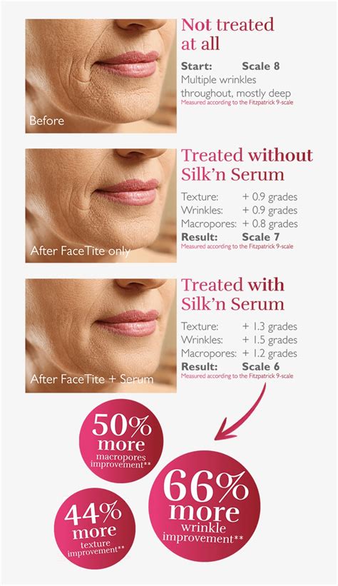 Silk'n Hyaluronic Serum - Silk N Facetite Reviews PNG Image ...