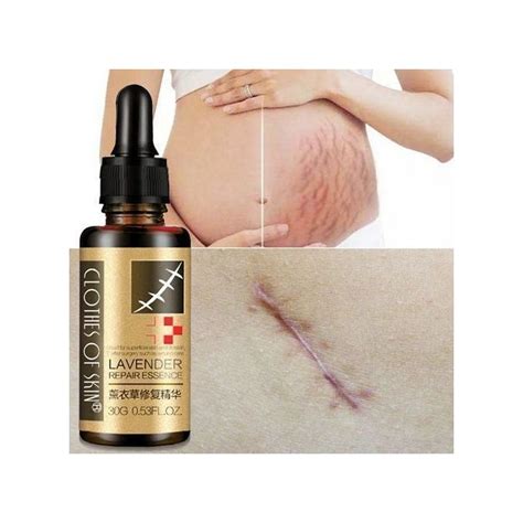 Lavender Scar and Stretch Mark Removal Oil – Dejmaxx