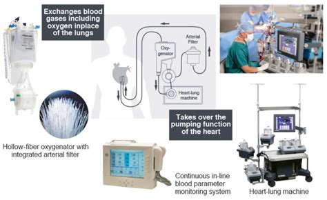 Terumo Cardiovascular - Medical Technologies & Systems Provider | Terumo Indonesia