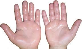 How to Get Rid of Clammy Hands Fast: 5 Quick Remedies for Sweaty Hands ...