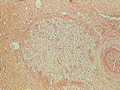 Ovary Histology - Corpus luteum - histology slide