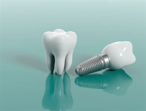 Complications That Can Occur After Dental Implant Surgery