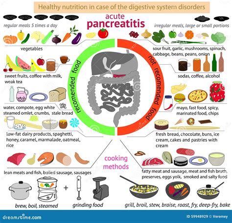 Infographics Nutrition In Case Of Pancreatitis. Cartoon Vector ...