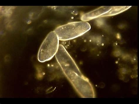 A Microscopic Sequence Showing Paramecium Dividing By Binary Fission Stock Footage Video 236788 ...