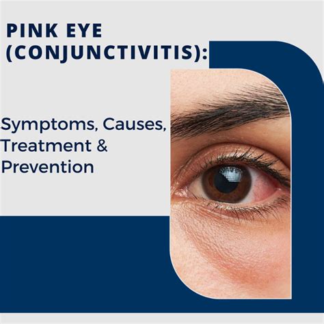 Pink Eye (Conjunctivitis): Symptoms, Causes, Treatment, & Prevention ...