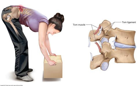 Tool Box Talk: Back Sprains and strains - HSSE WORLD