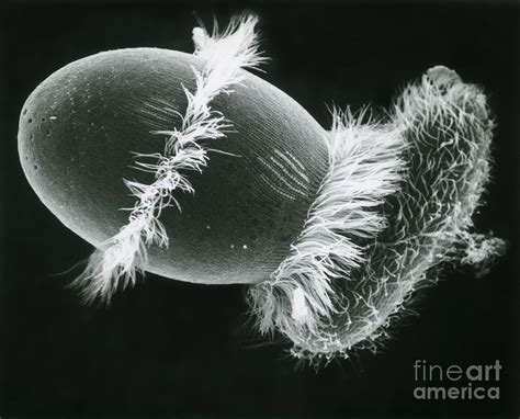 Didinium Ingesting A Paramecium Photograph by Greg Antipa