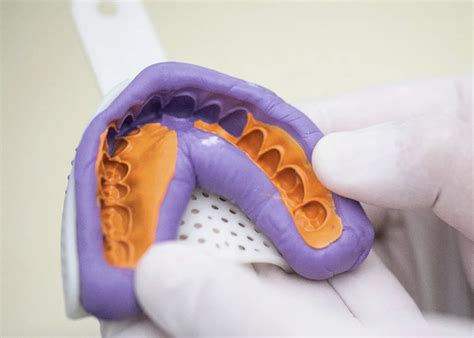 Material De Impresión Elastomérica De Silicona,Gran Cuerpo De Luz Dental Perfit Vps - Buy Dental ...