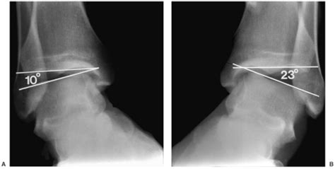 Imaging Techniques | Radiology Key